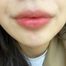 인핸서 이미지