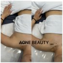 제주케어메디칼 | 황금동윤곽관리,수성구윤곽관리잘하는곳은 에이원뷰티