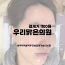 [미아 우리맑은의원] 미아 점 저렴하게 빼는 피부과 방문 후기 (1개당 1100원)