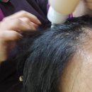 의정부 두피케어, 에스뷰티샵 문제성두피 케어 후기