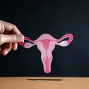 리즈케어 네이버블로그