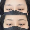 [공지] 안녕하세요. 시우뷰티 대표원장 스칼렛입니다.