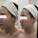 홍대 피부관리 예본에서