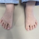 서울고든병원 | 발산 내성 발톱무좀 고민 병원에서 한 번에 해결