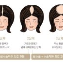 가르마 이미지