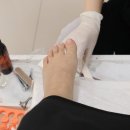 아이율네일