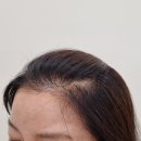미로헤어라인 이미지