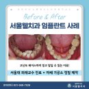 웰치과기공소 이미지
