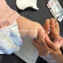 닥터지니성형외과의원 | #3. 대구 닥터지니성형외과 선천성멜라닌세포모반 제거 후기｜실밥 제거부터 흉터관리까지 총정리