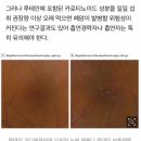 눈에 좋다고 루테인 과다복용하면 시력 해칠 위험 이미지