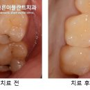 e-플란트치과 이미지