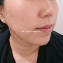 세종메디칼 | 세종피부관리 맛집 어진동 캄뷰티 보타닉가든에서 메디컬 특수 앰플관리 받고 온 생생 후기