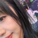 서클 | 울트라콜 효과 다크서클 시술 후기 with 트라이덤