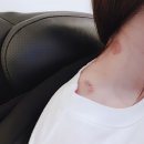 이엽한의원 네이버블로그