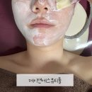 울산 달동 피부관리 제이앤에스뷰티풀 써마트릭스 관리후기