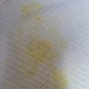 RR-302[만세로]-하-1 | 301일 9개월 아기의 노로바이러스 입원기(가야 에덴어린이병원 후기 입원실,병원비용 등등)