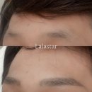 라라스타(Lalastar)