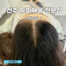 전주채우림 | 전주두피채움 탈모커버 채우림 가르마커버 후기