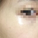 (주)퍼피웍스 | 본트리 퍼피퍼피 쓰리스텝 모공팩으로 집중관리하세요 ^^
