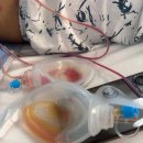 계룡면옥정육점 | [간병 일지] 서울아산병원 간이식 공여자 수술 후기 마지막(10~12일차)