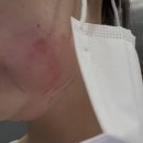 쁨글로벌의원 이미지