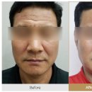 휴킨스피부과의원 이미지