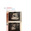 드시고오슈 | 블랙마카 드시고 좋은 도움이 되셨다고 연락주신 후기들 일부 추려서 보여드려요
