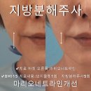 【얼굴】마리오네트라인 개선 이미지