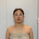 물리치료사가 알려주는 통증 관리, 셀프마사지& 스트레칭 | [김해] 물리치료사의 전매특허 동안관리 &#39;김해 수에스테틱&#39; 내돈내산후기