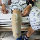 참의수족보조기 이미지