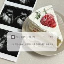여보게친구 차나한잔먹음세 | [임신 23주~25주차] 2차 정밀초음파, 임당재검, 공공산후조리원 예약 성공 꿀팁, 손목 저림, 다리 붓기