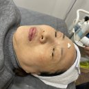 가수원상점가 | 가수원동 아티스트비에스 대전 피부관리 잘하는 곳 스킨플래닝 후기