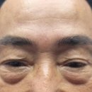 태안읍사무소 | 남자눈썹(자연스러운남자눈썹)