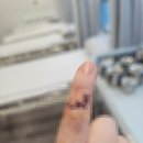 미사정형외과의원 | 손가락상처봉합 - 미사역에 위치한 정형외과 후기