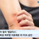 메디칼릴리 이미지