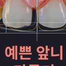 부평스마트치과의원 네이버블로그