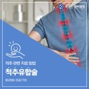 척추수술병원, 서재곤링커병원의 척추유합술 이미지