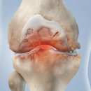 고산정형외과의원 이미지