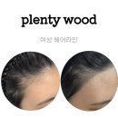 조헤어라인 이미지