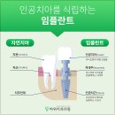 쁘띠치과의원 네이버블로그