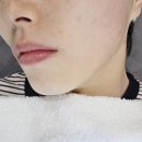 수원망포피부관리 가은에스테틱 촉촉한 페이스관리