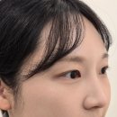 더림 | 수유역 속눈썹펌 더림제이에서 볼륨앰플펌 후기와 주의사항