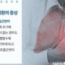 숨이 점점 가빠진다?…폐 굳는 '간질성페질환' 의심해봐야" 이미지