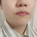 크로스메드 이미지