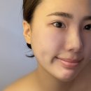엘리유스킨 이미지
