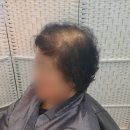 김호증모가발by헤어리서치 이미지