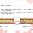 퀸테라피 이미지