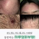 고운누리피부과