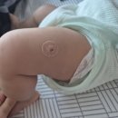 동탄아이언소아청소년과의원 | RSV 예방 항체주사 베이포투스 접종 후기 (동탄아이언소아청소년과)