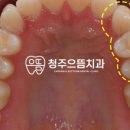 청주으뜸치과의원 이미지